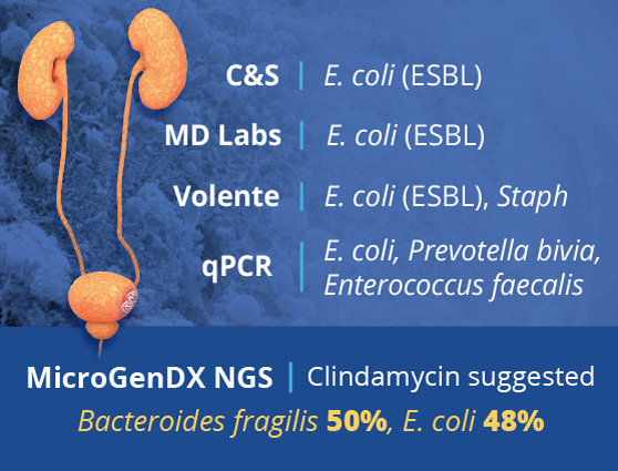 microgendx bacteroides fragilis microgendx bacteroides fragilis