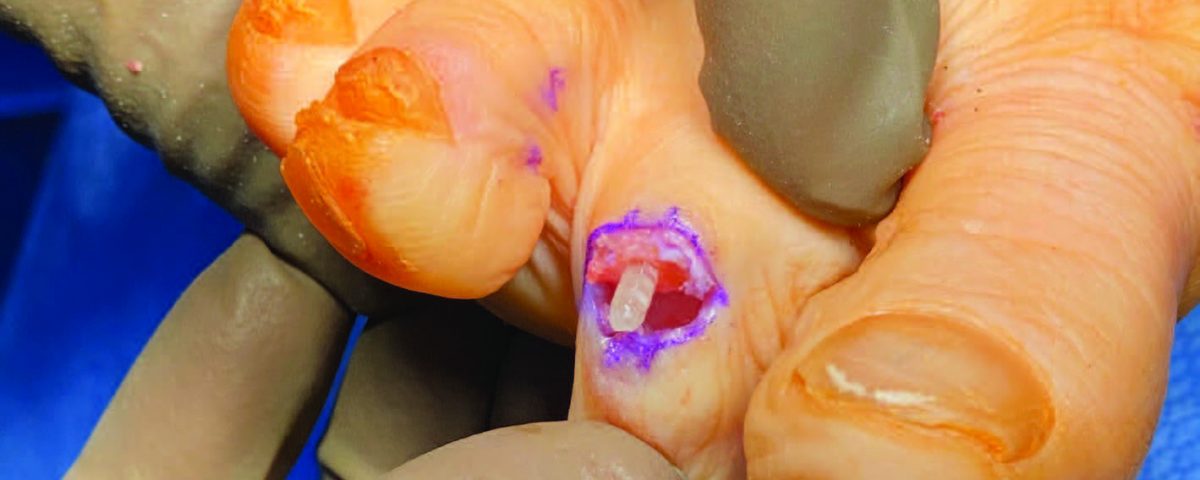 podiatry advancements