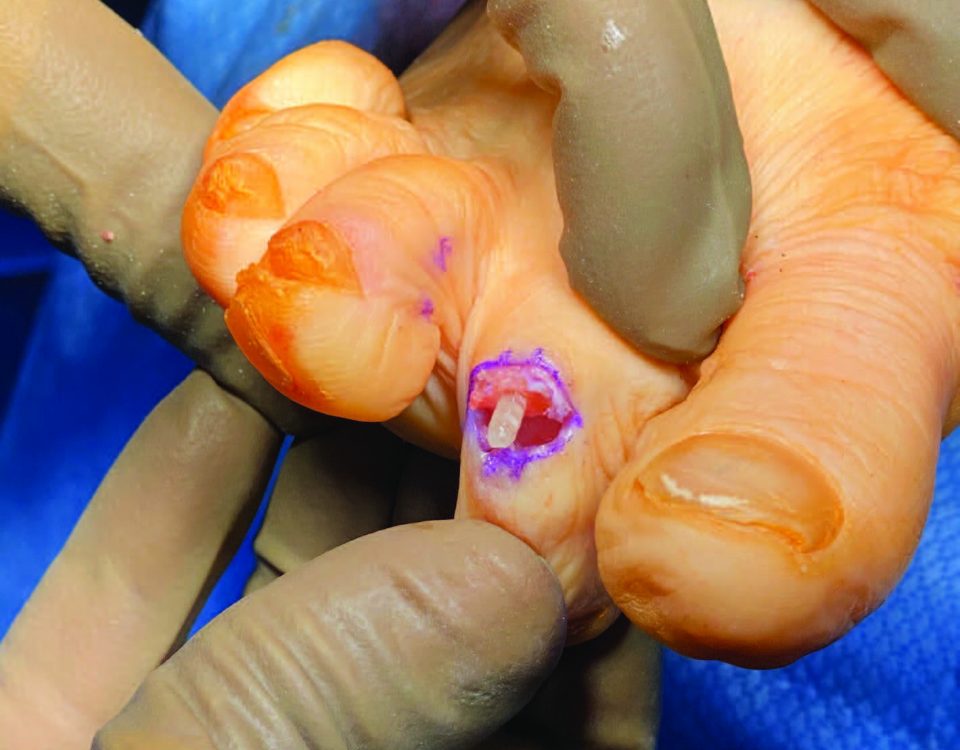 podiatry advancements